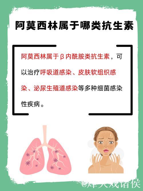 阿莫林或将调整阵型为4-3-3 阿莫林或将调整阵型为4-3-3